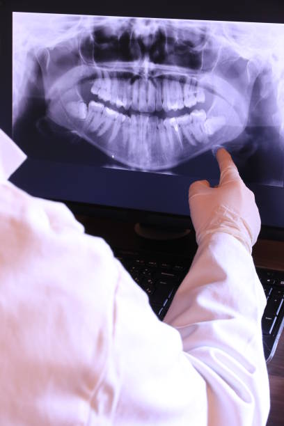 Best Emergency Treatment for Dental Infections or Abscesses in Eastpoint, FL