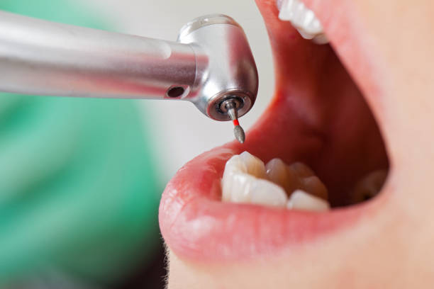 Best Emergency Dental Care for Broken or Chipped Teeth in Eastpoint, FL